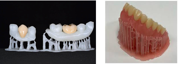 3D-Printed-Crowns and 3D-Printed-Denture