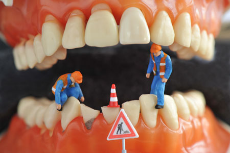 Tiny people working on damaged teeth